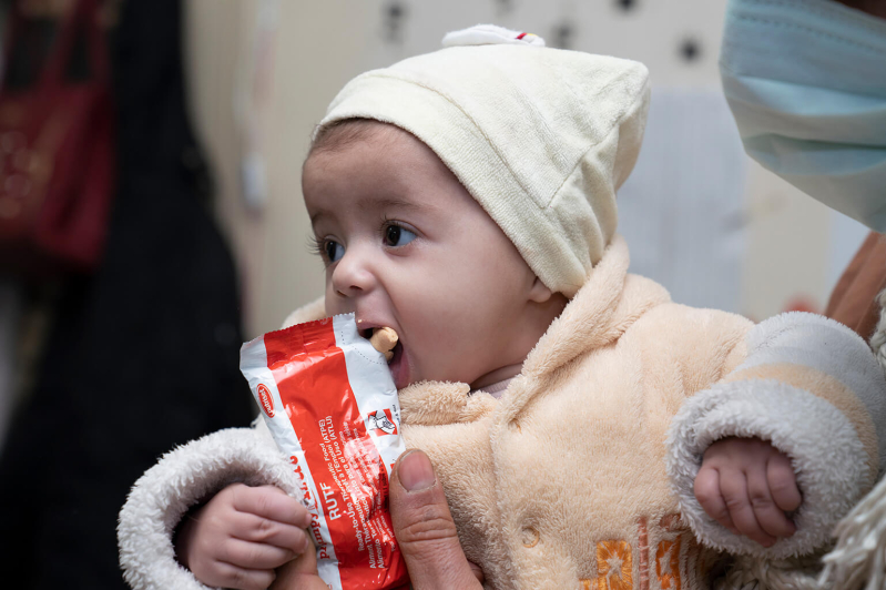 Niedożywienie UN0824879.jpg