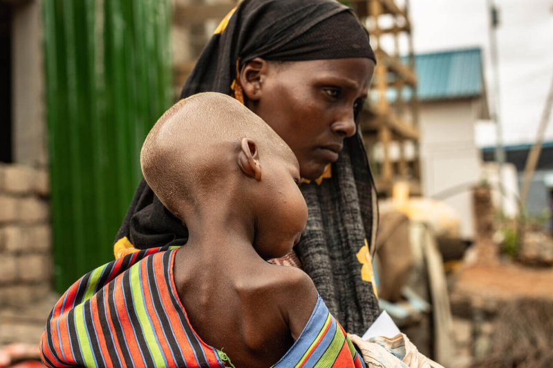 Matka z niedożywionym dzieckiem - Somalia