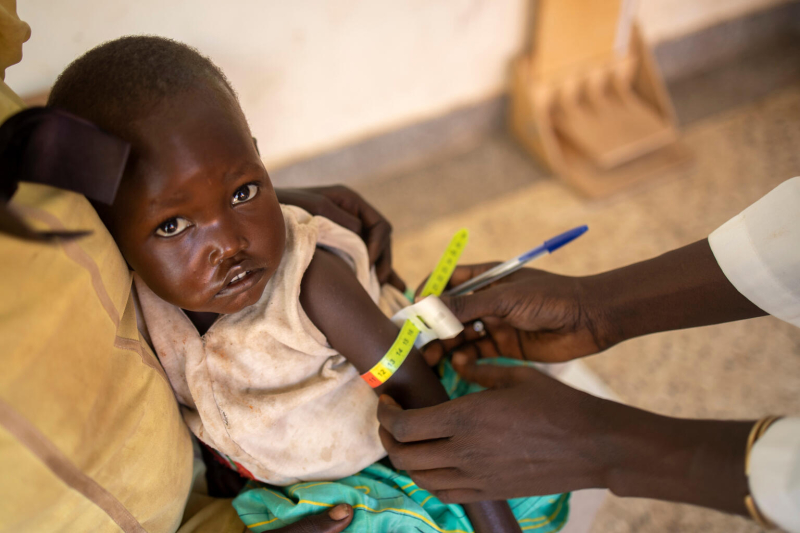 UNICEF badanie dziecka pod kątem niedożywienia