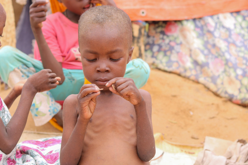 Dzieci na skraju śmierci głodowej