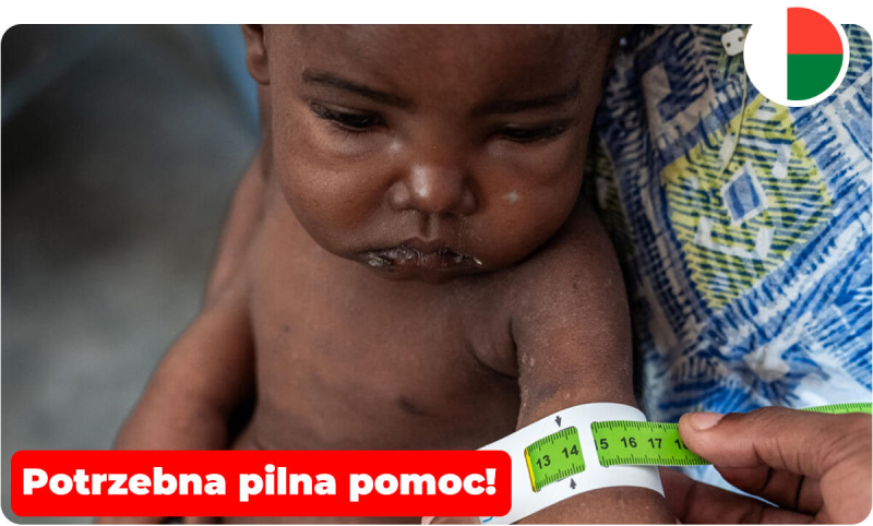 Marco z Madagaskaru: małych chłopczyk z ciężkim niedożywieniem.