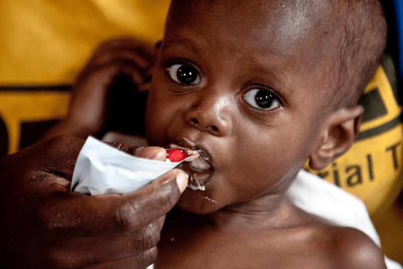 Co czwarte dziecko na świecie jest niedożywione