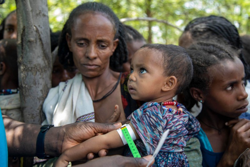W północnej Etiopii liczba niedożywionych dzieci wzrosła dziesięciokrotnie, alarmuje UNICEF