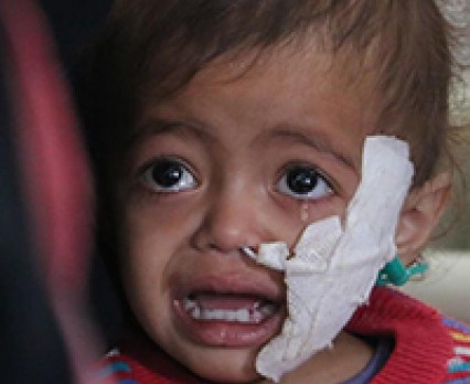 W Jemenie i Sudanie Południowym 650 tysięcy dzieci jest zagrożonych śmiercią głodową