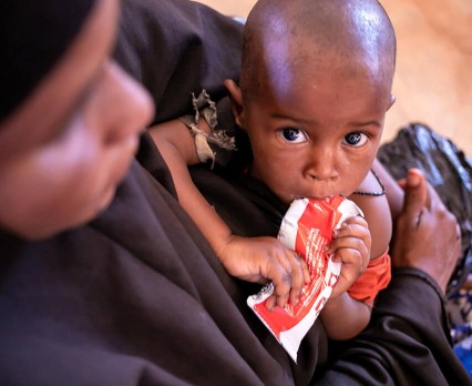 Świat jest u progu katastrofalnego poziomu niedożywienia u dzieci
