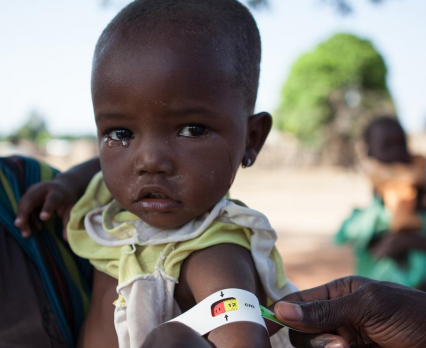 Poziom niedożywienia dzieci w Mali alarmująco wysoki
