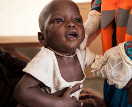 Umara – skrajnie niedożywiony chłopiec z Nigerii